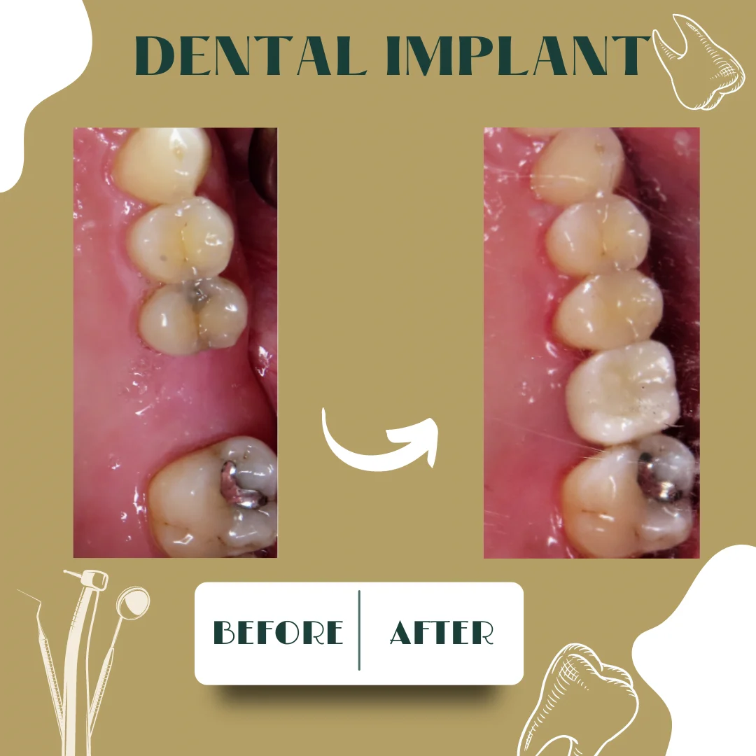 Dental clinical case 3, before and after