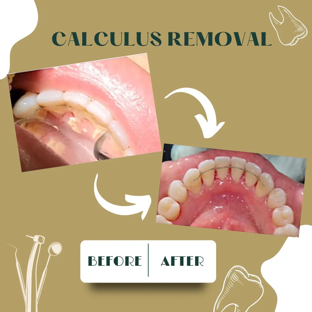 Dental case, before and after 1