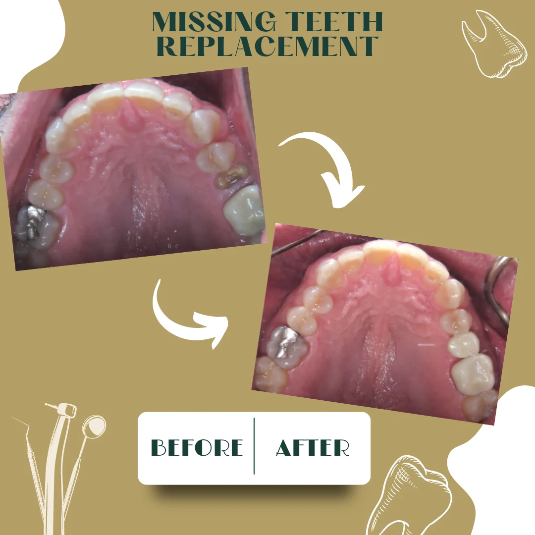 Dental case, before and after 25