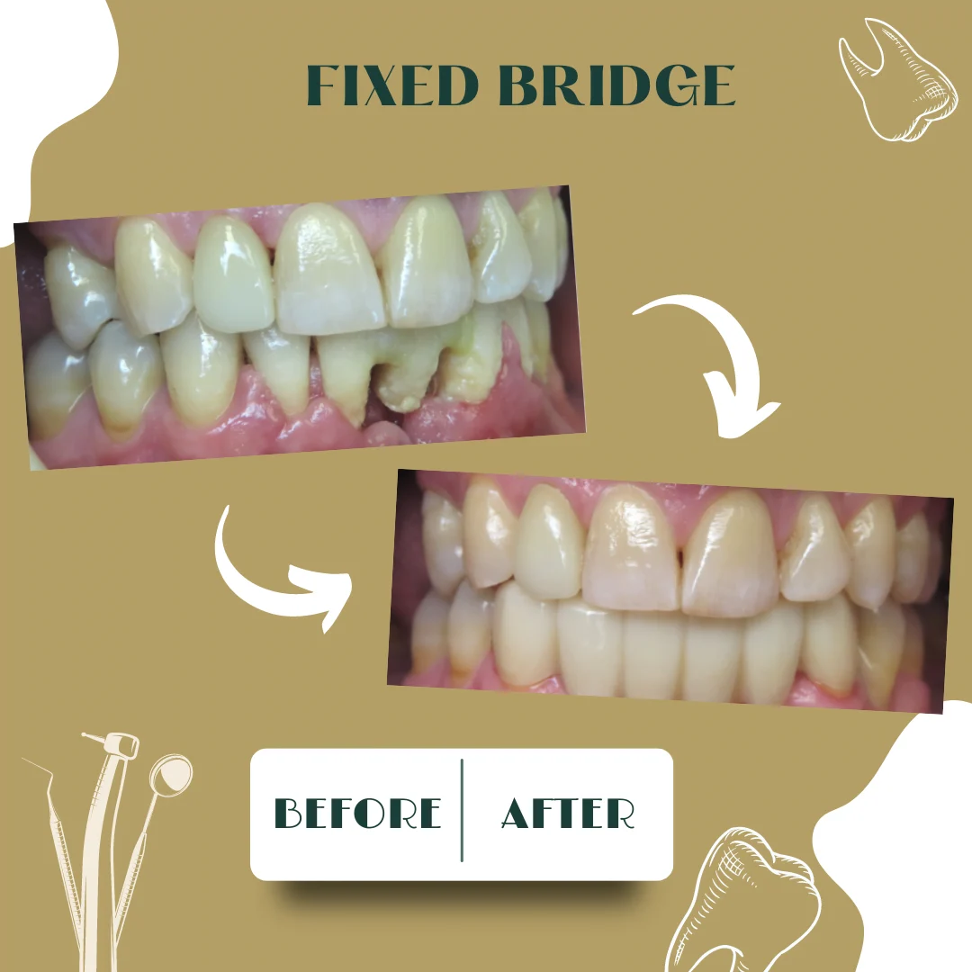 Dental case, before and after 24