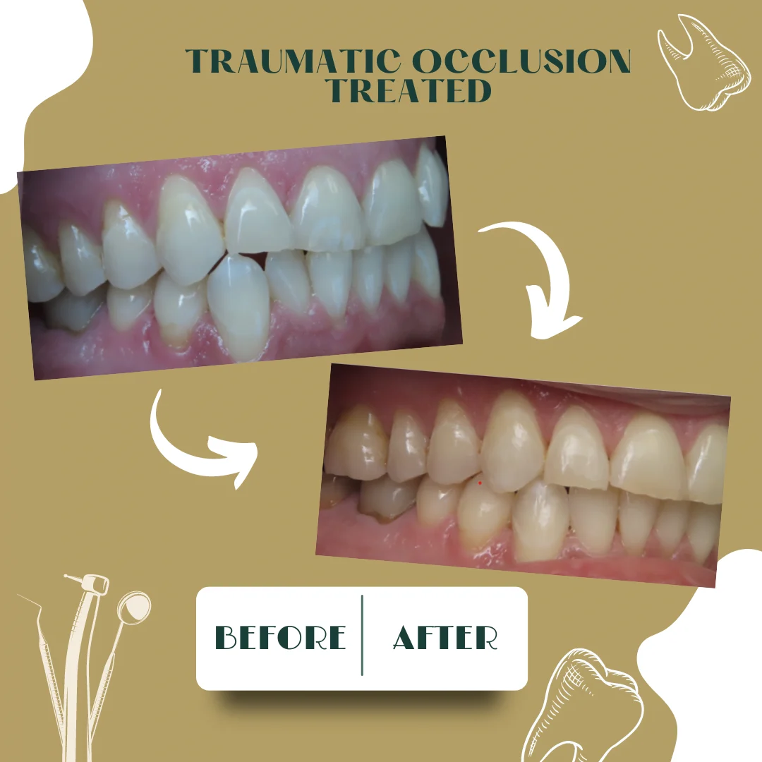 Dental case, before and after 21