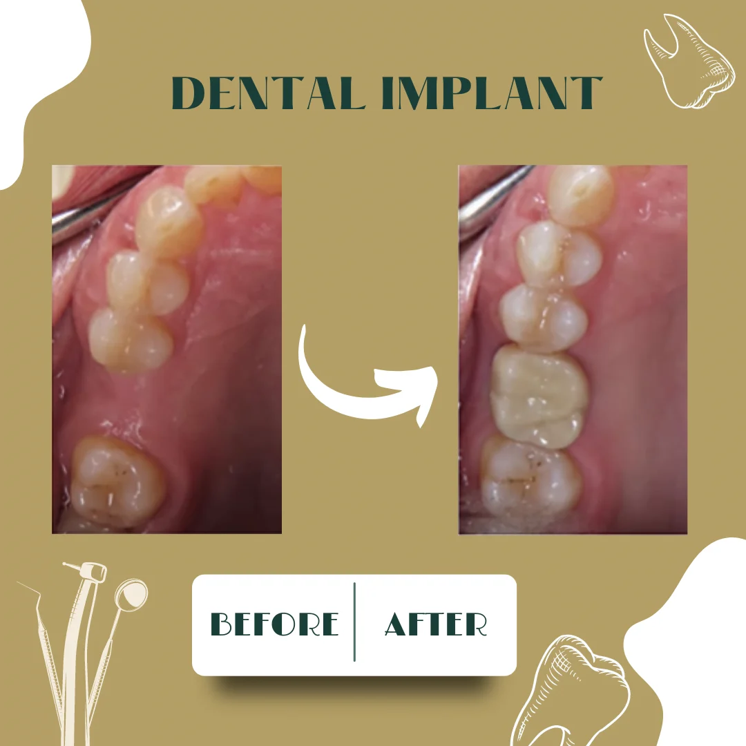 Dental case, before and after 4