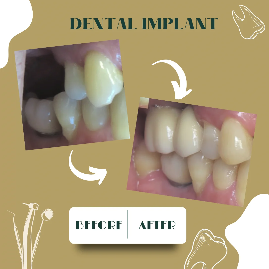 Dental case, before and after 22