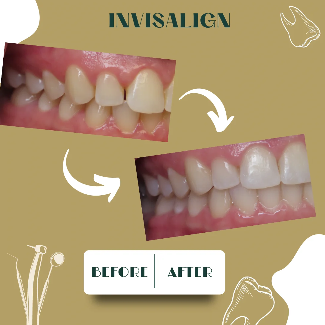 Dental case, before and after 18