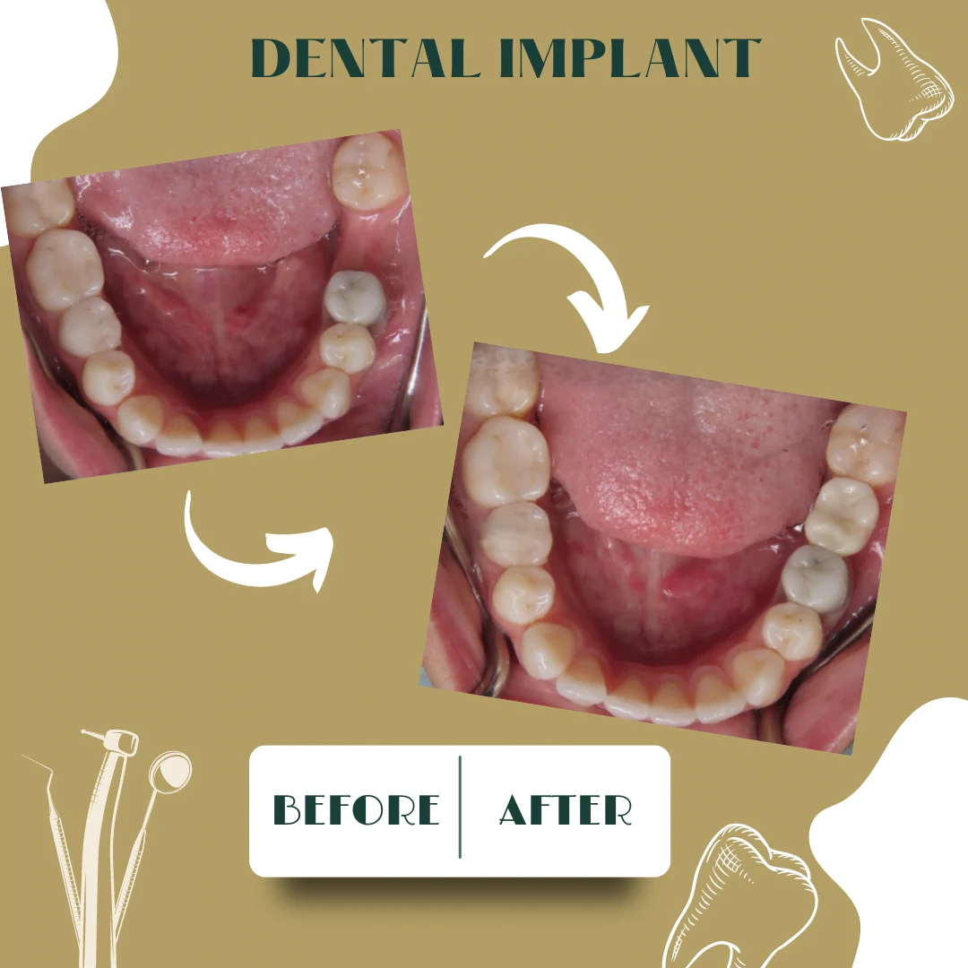 Dental case, before and after 29