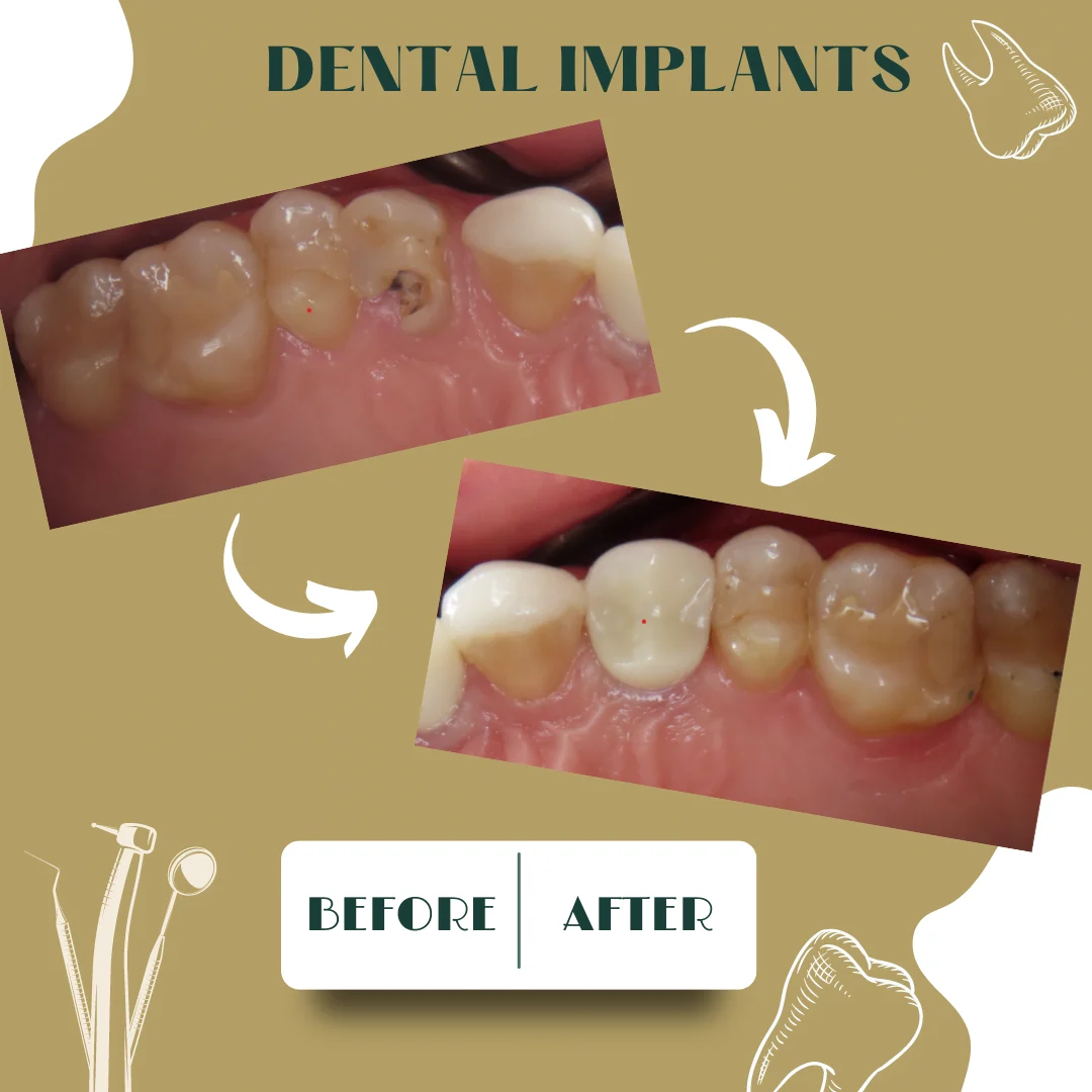 Dental case, before and after 19