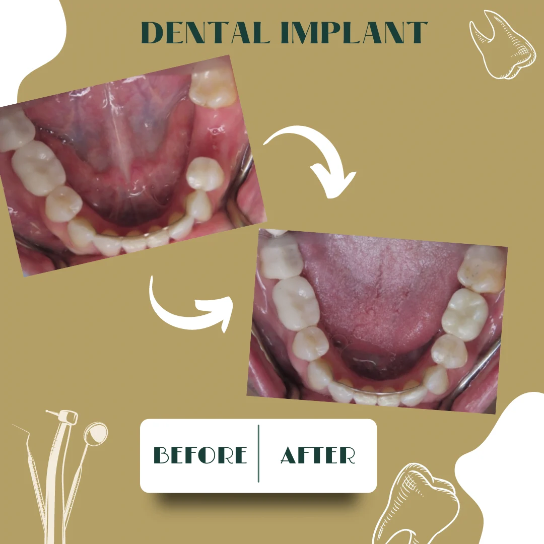 Dental case, before and after 30