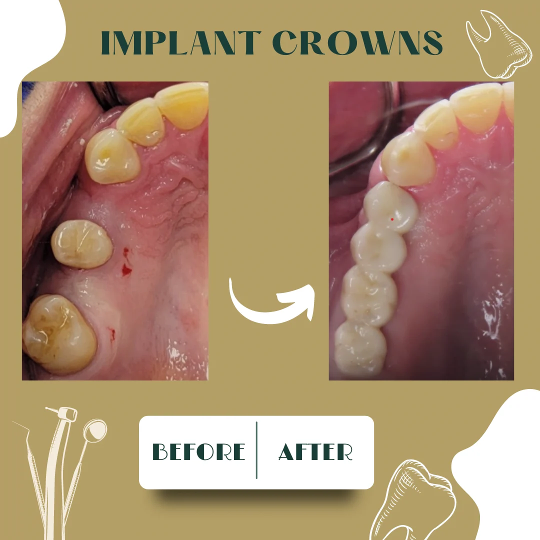 Dental case, before and after 12