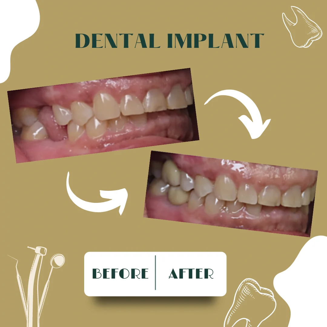 Dental case, before and after 5