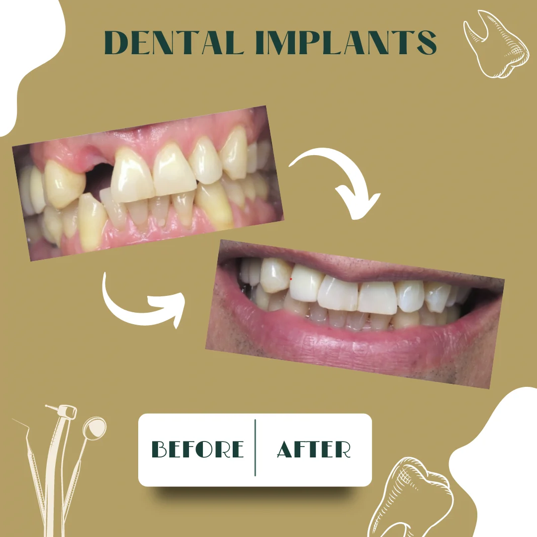 Dental case, before and after 14