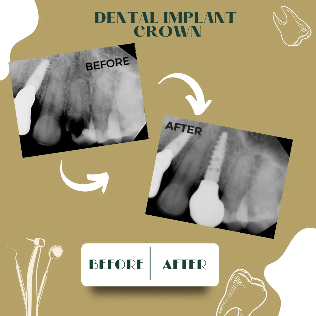 Dental case, before and after 17