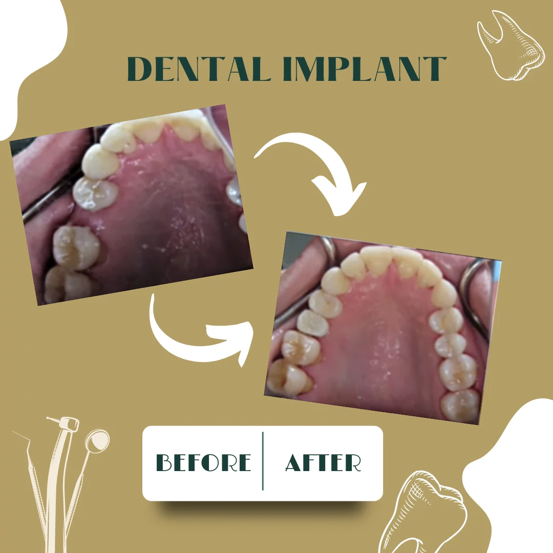 Dental case, before and after 3