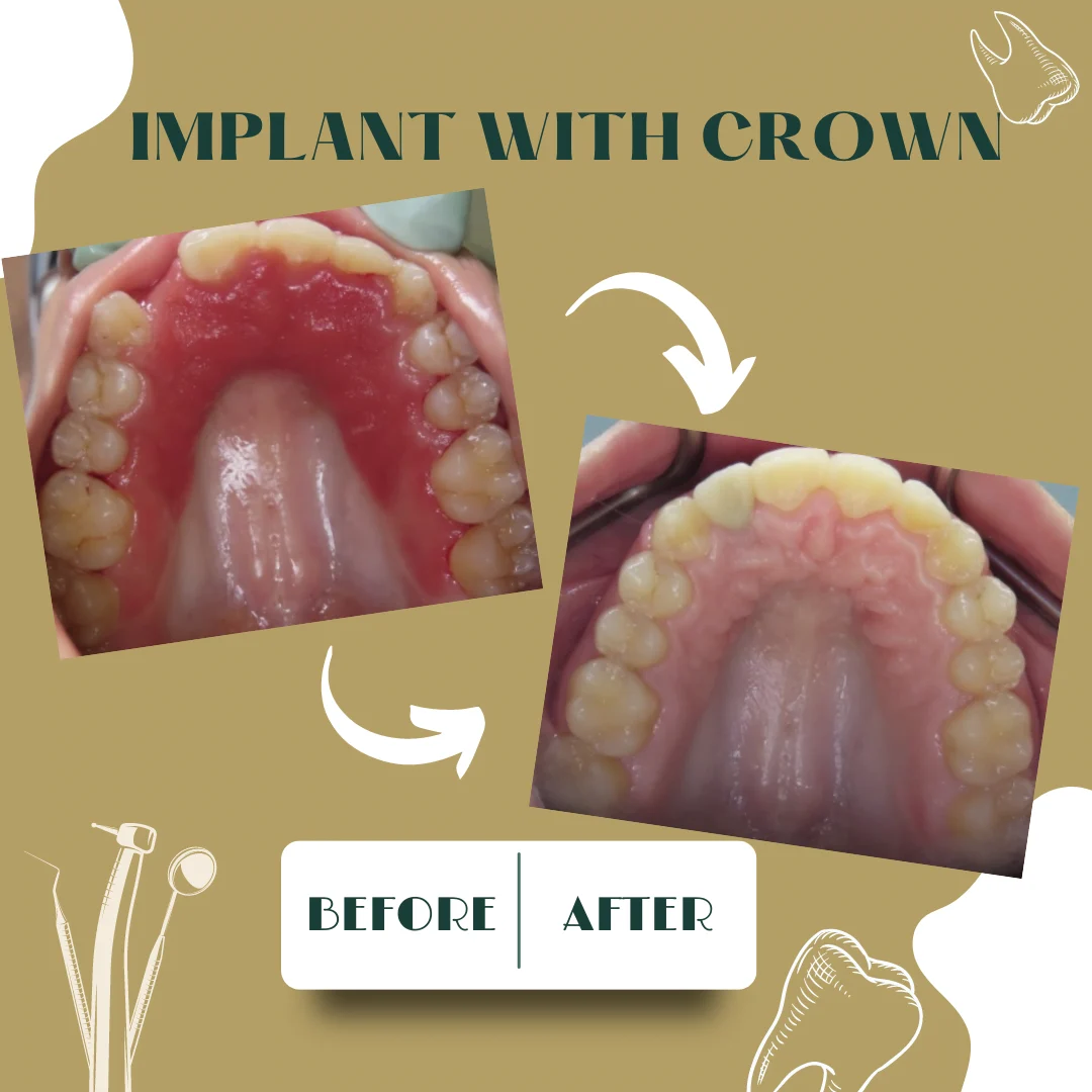 Dental case, before and after 8