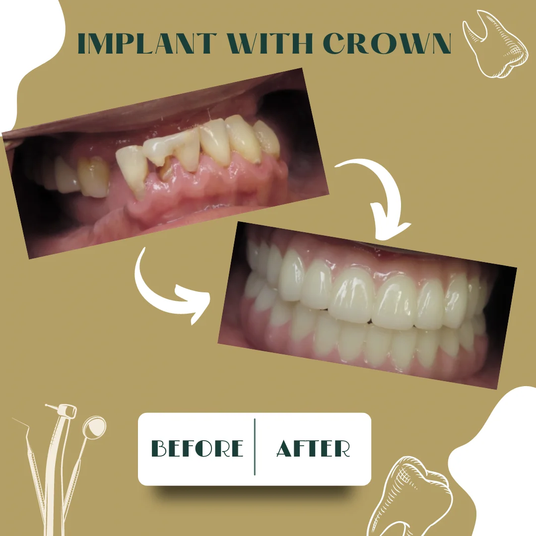 Dental case, before and after 11