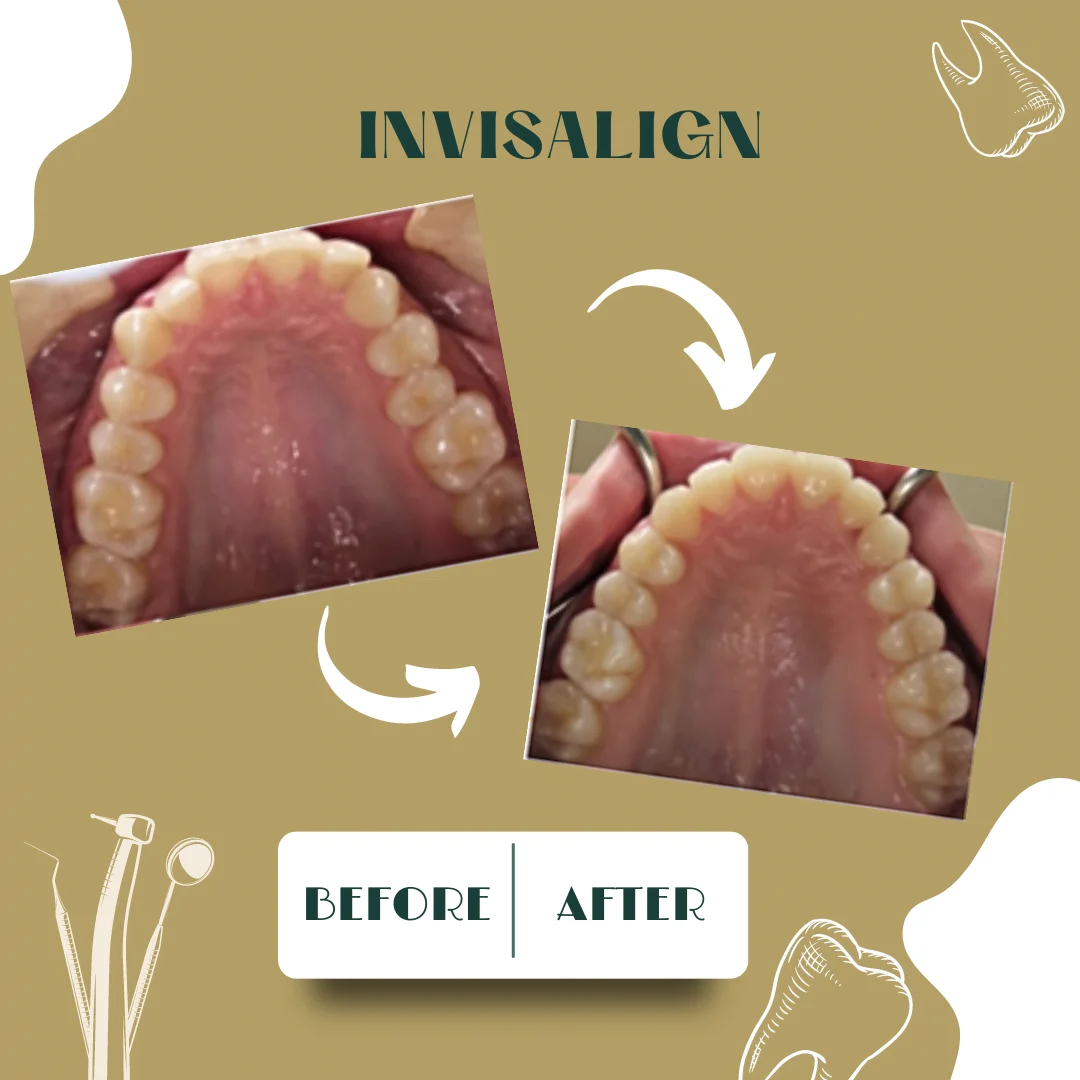 Dental case, before and after 7