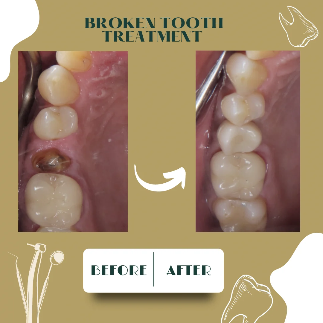 Dental case, before and after 15