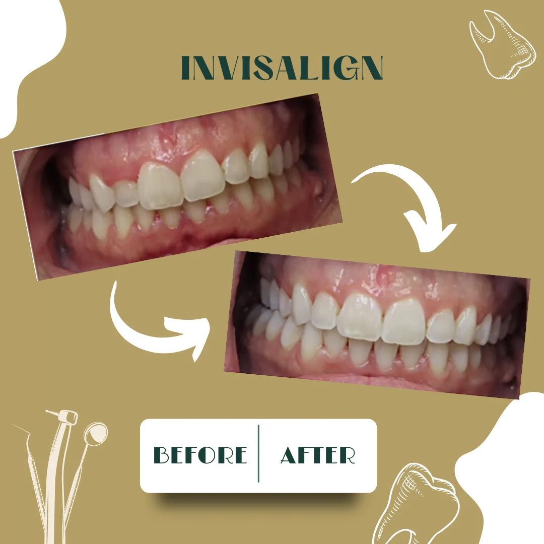 Dental case, before and after 2