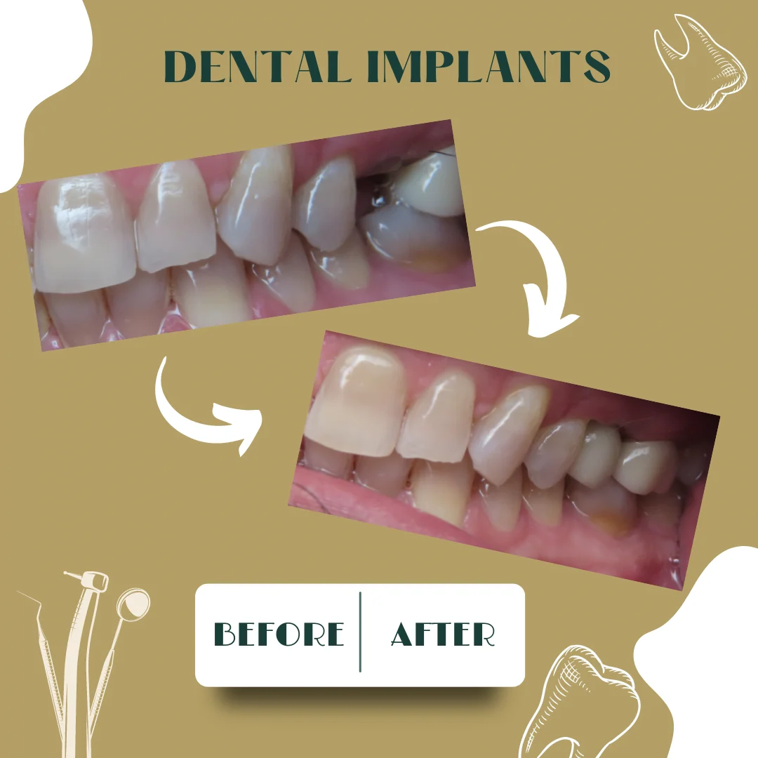 Dental case, before and after 20