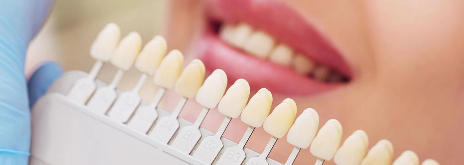 Illustrative image of dental care and services