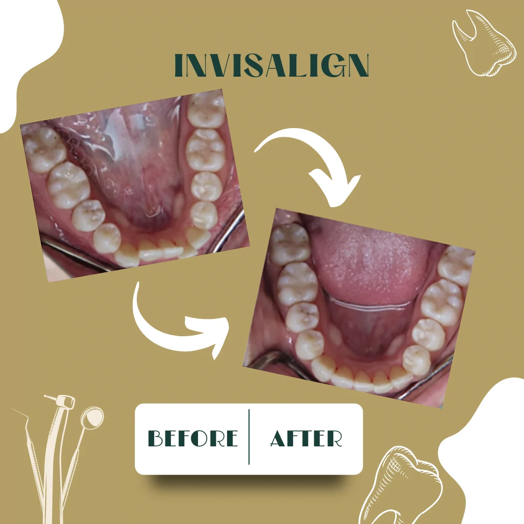 Dental case, before and after 6