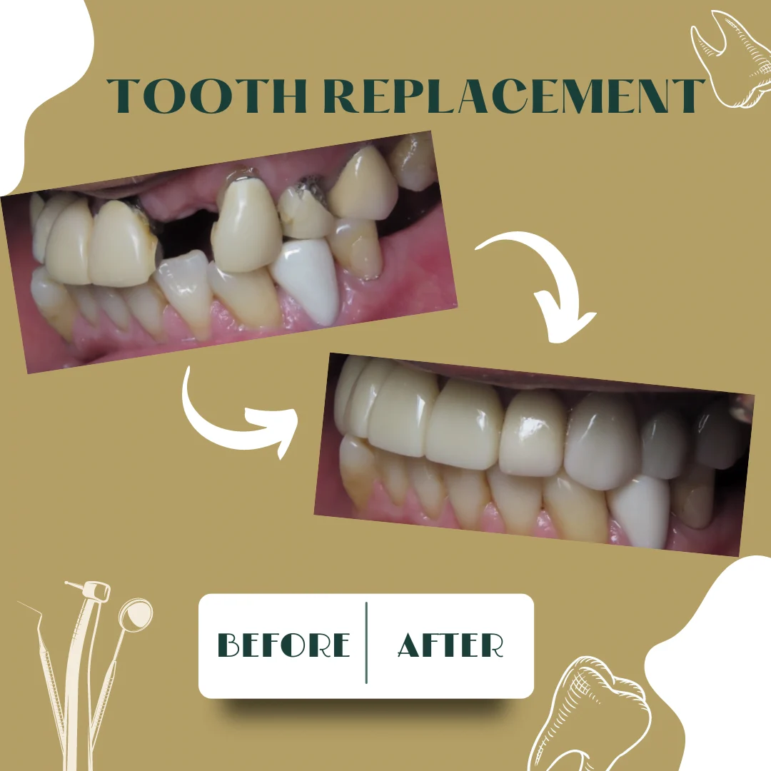 Dental case, before and after 9