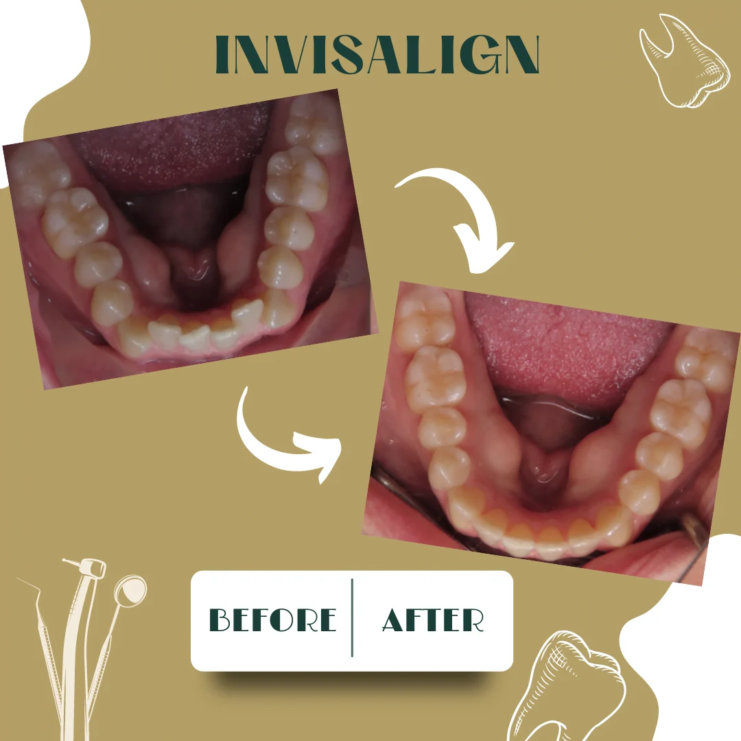 Dental case, before and after 26